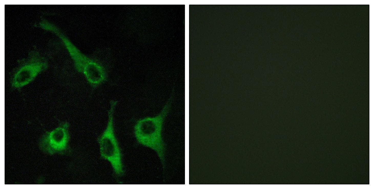 Polyclonal Rabbit anti-Human S1PR1 / EDG1 / S1P1 Antibody (IF, WB)