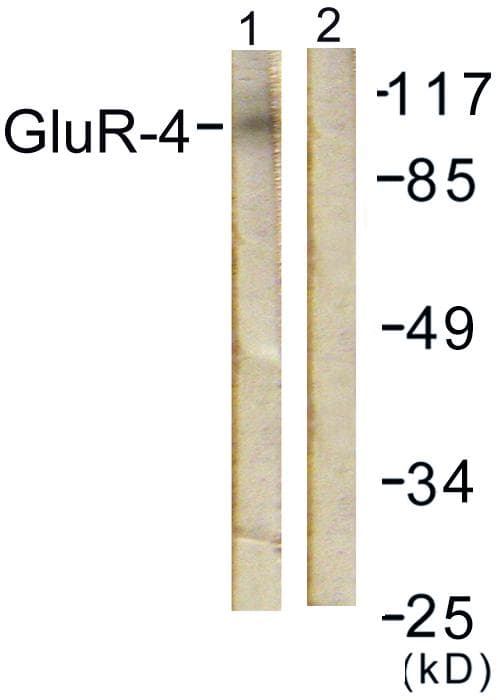 GRIA4 / GLUR4 Antibody (p862)