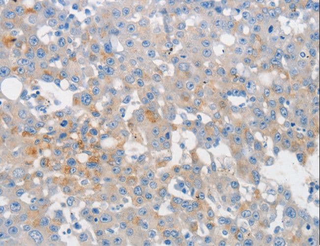 MUC5AC Antibody