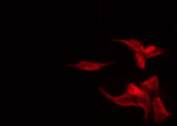 BCL2 / Bcl-2 Antibody (phospho-Thr69)