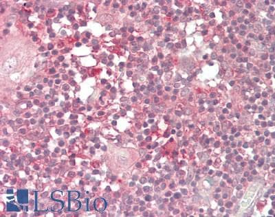 IHC-plus™ Polyclonal Rabbit anti-Human LENG8 Antibody (aa489-664, IHC, WB)