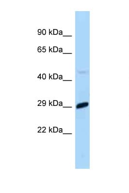 Polyclonal Rabbit anti-Mouse MXD1 / MAD1 Antibody (C-Terminus, WB)