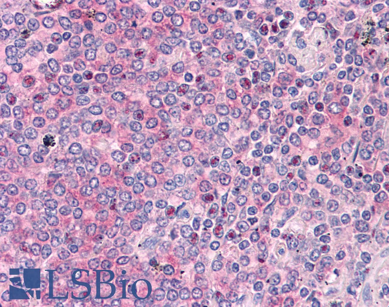IHC-plus™ ADAM17 / TACE Antibody (clone 1F6)
