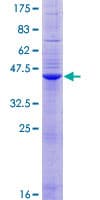 Human SLC11A1 / NRAMP Protein (Recombinant GST)