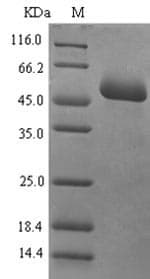 Human MAdCAM-1 Protein (Recombinant 6His-SUMO, N-terminus)
