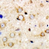 Polyclonal Rabbit anti-Human ANKRD52 Antibody (IHC, WB)