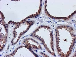 LACTB2 Antibody (aa78-288, clone OTI2F9)