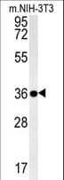 Polyclonal Rabbit anti-Human LGALS9B Antibody (aa160-188, WB)