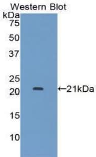 CD118 / LIF Receptor Alpha Antibody (aa522-691)