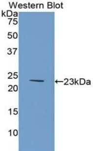 COL6A1 / Collagen VI Alpha 1 Antibody (aa828-1022)