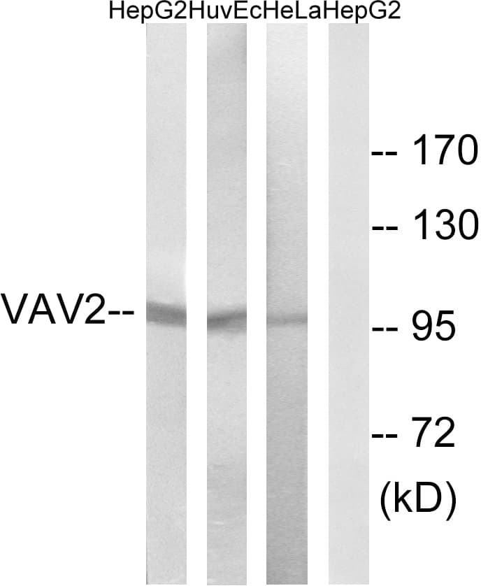Polyclonal Rabbit anti-Human VAV2 Antibody (aa108-157, IHC, IF, WB)