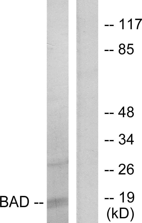 Polyclonal Rabbit anti-Human BAD Antibody (aa102-151, IHC, WB)