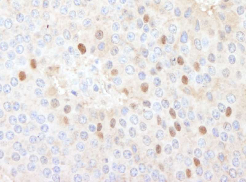 CDT1 Antibody (aa500-C-term)