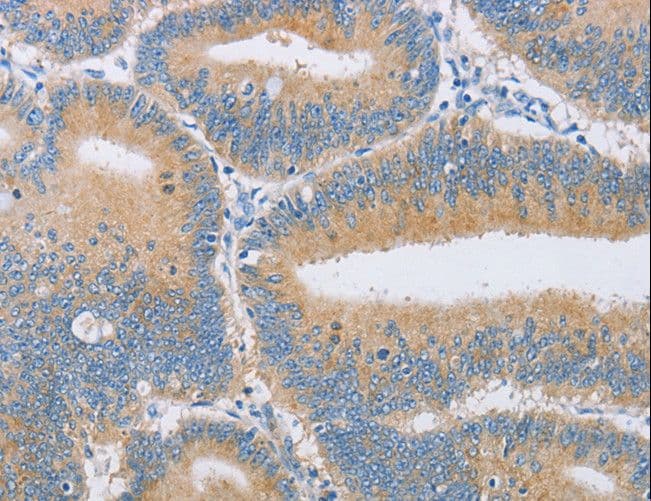 Polyclonal Rabbit anti-Human CENPE Antibody (IHC)