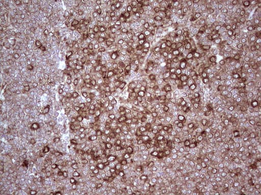 YBX1 / YB1 Antibody (clone OTI7B4)