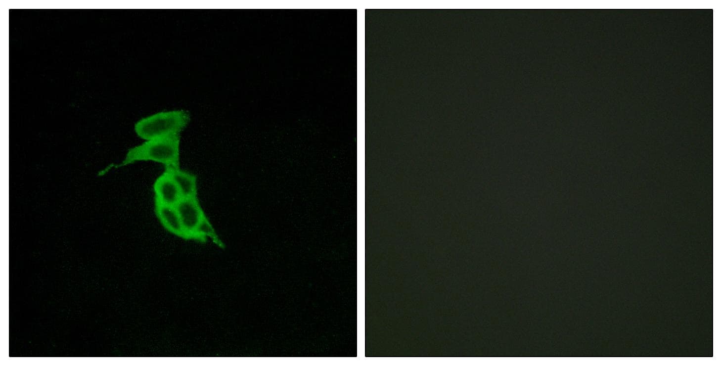 Polyclonal Rabbit anti-Human GPR143 Antibody (IF)