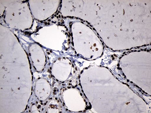 ELL / MEN Antibody (aa302-621, clone OTI2H7)