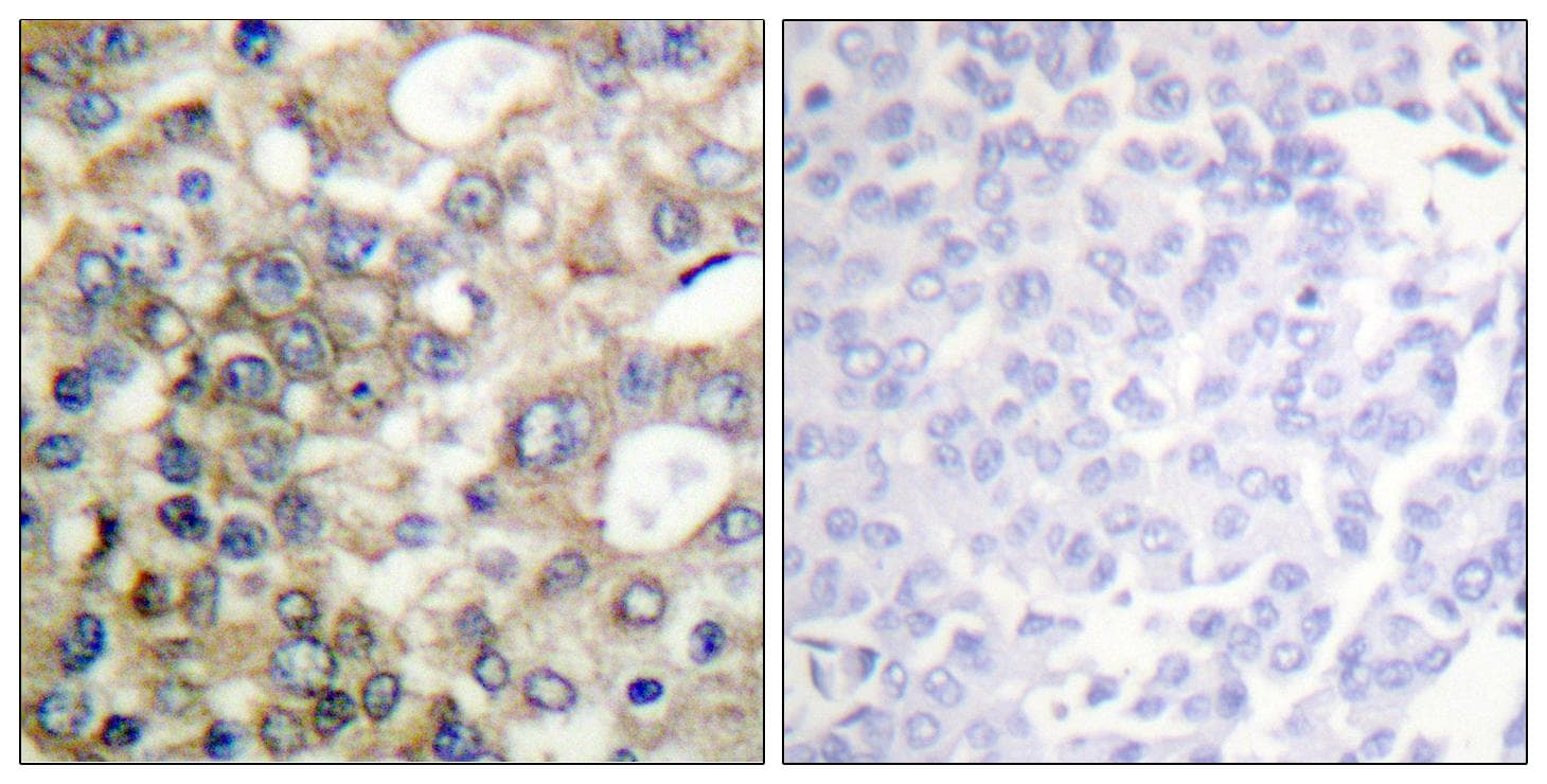 Polyclonal Rabbit anti-Human EMA / MUC1 Antibody (phospho-Tyr1229, IHC, IF, WB)