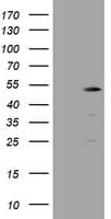 TBC1D13 Antibody (clone OTI2C5, Carrier-free)