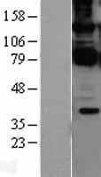 CARMA1 / CARD11 Protein (Over-Expression Lysate Myc-DDK (Flag))