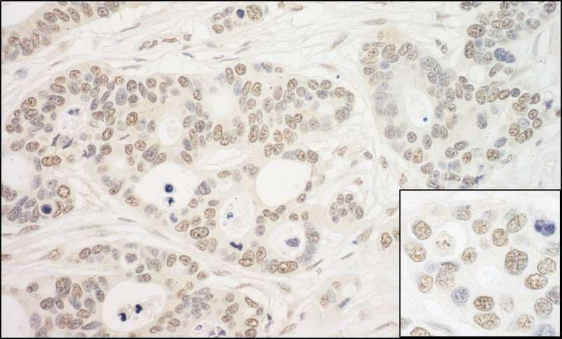 PRPF6 / TOM Antibody (aa1-50)
