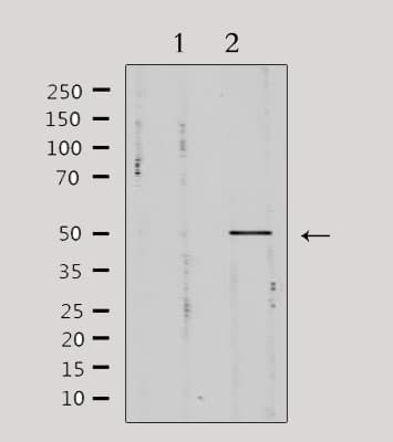 PIM1 / Pim-1 Antibody