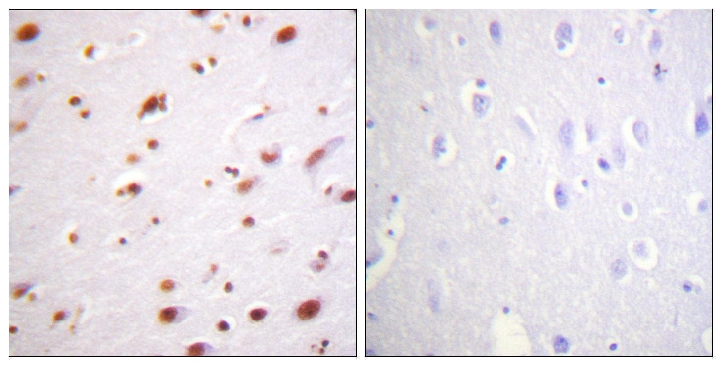 CTNND1 / p120 Catenin Antibody (phospho-Tyr228)
