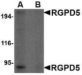 IHC-plus™ Polyclonal Rabbit anti-Human RGPD5 Antibody (IHC, WB)