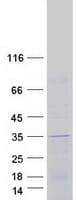 Human FAM207A Protein (Recombinant Myc-DDK (Flag))