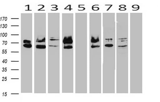Monoclonal Mouse anti-Human PR / Progesterone Receptor Antibody (clone OTI29A3, aa1-298, WB)