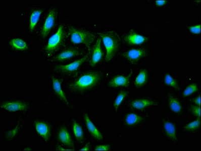 TMEM192 Antibody