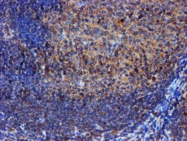 IDS / Iduronate 2 Sulfatase Antibody (clone OTI4G2)