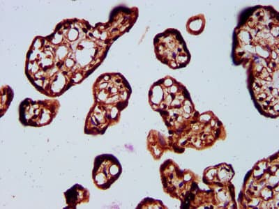SOS1 Antibody