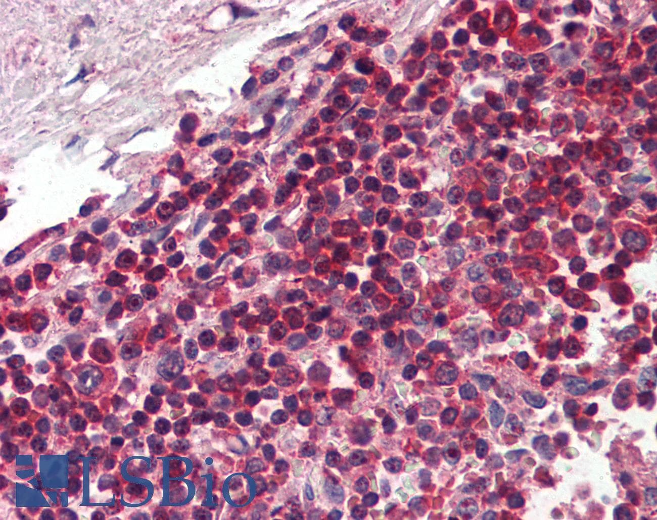 IHC-plus™ TLR8 Antibody (aa750-850, clone 44C143)
