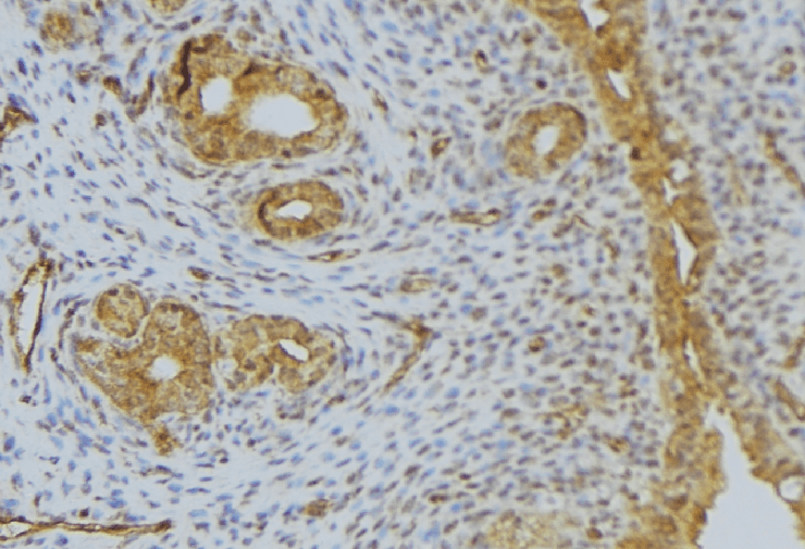Polyclonal Rabbit anti-Human DEFB132 Antibody (IHC, WB)