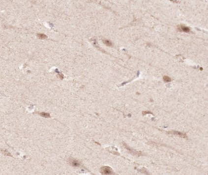 TNFRSF1A / TNFR1 Antibody