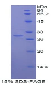 Human MYO1G / HA2 Protein (Recombinant His)