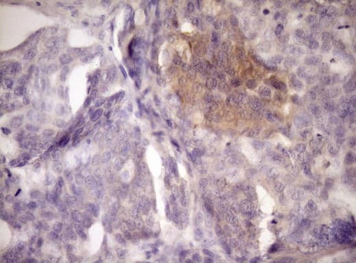 LOXL2 Antibody (aa152-450, clone OTI8B2)