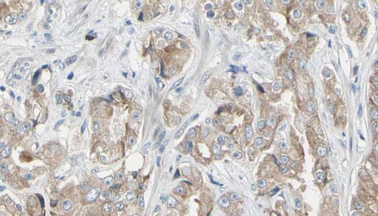 RPS4Y2 Antibody