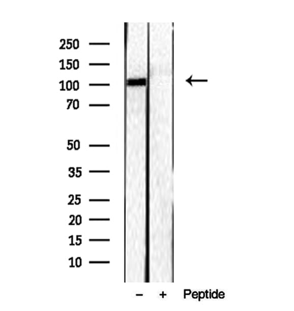 Polyclonal Rabbit anti-Human RBM15 Antibody (IHC, WB)