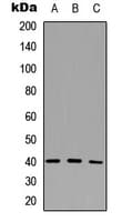 Polyclonal Rabbit anti-Human CD72 Antibody (Internal, WB)