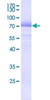 Human HLA-E Protein (Recombinant GST)