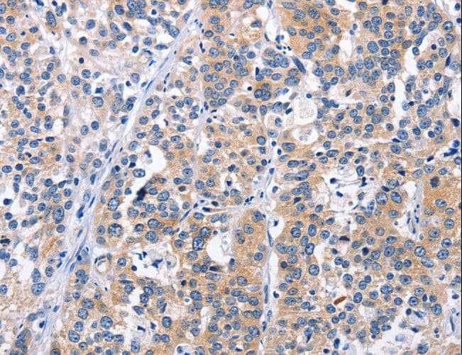 Polyclonal Rabbit anti-Human CEP97 Antibody (IHC, WB)