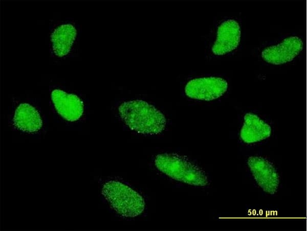 TCF7 Antibody (clone 1D2)
