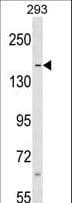 Polyclonal Rabbit anti-Human SAFB1 / SAFB Antibody (aa65-94, WB)