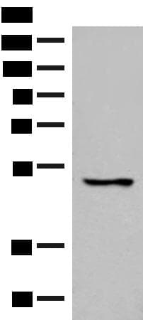 Polyclonal Rabbit anti-Human GPR152 Antibody (IHC, WB)