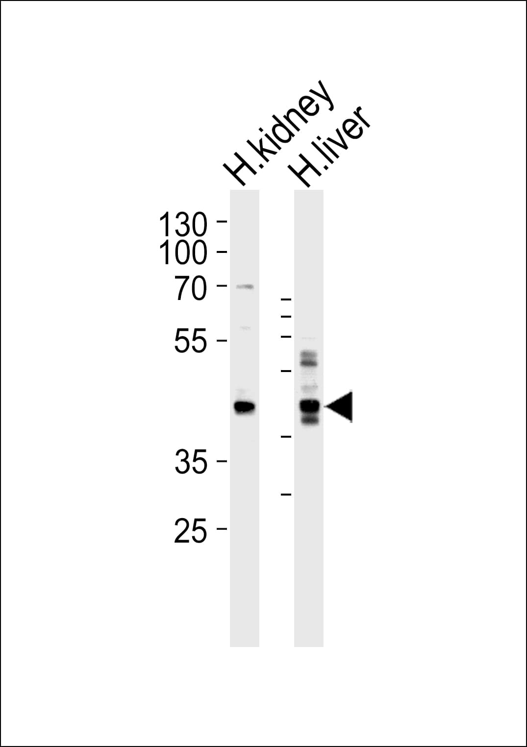 Polyclonal Rabbit anti-Human MAFK Antibody (aa57-85, IHC, WB)