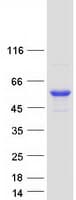 Human CYP4F11 Protein (Recombinant Myc-DDK (Flag))