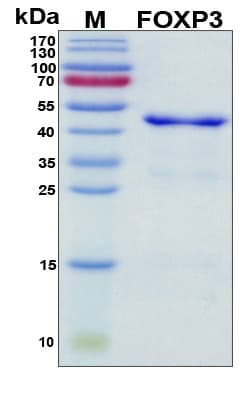 Human FOXP3 Protein (Recombinant His, N-Terminal)