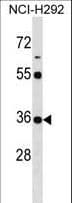 KCTD17 Antibody (aa107-136)